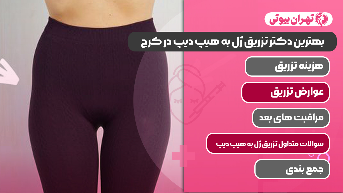 10 بهترین دکتر تزریق ژل به هیپ دیپ در کرج