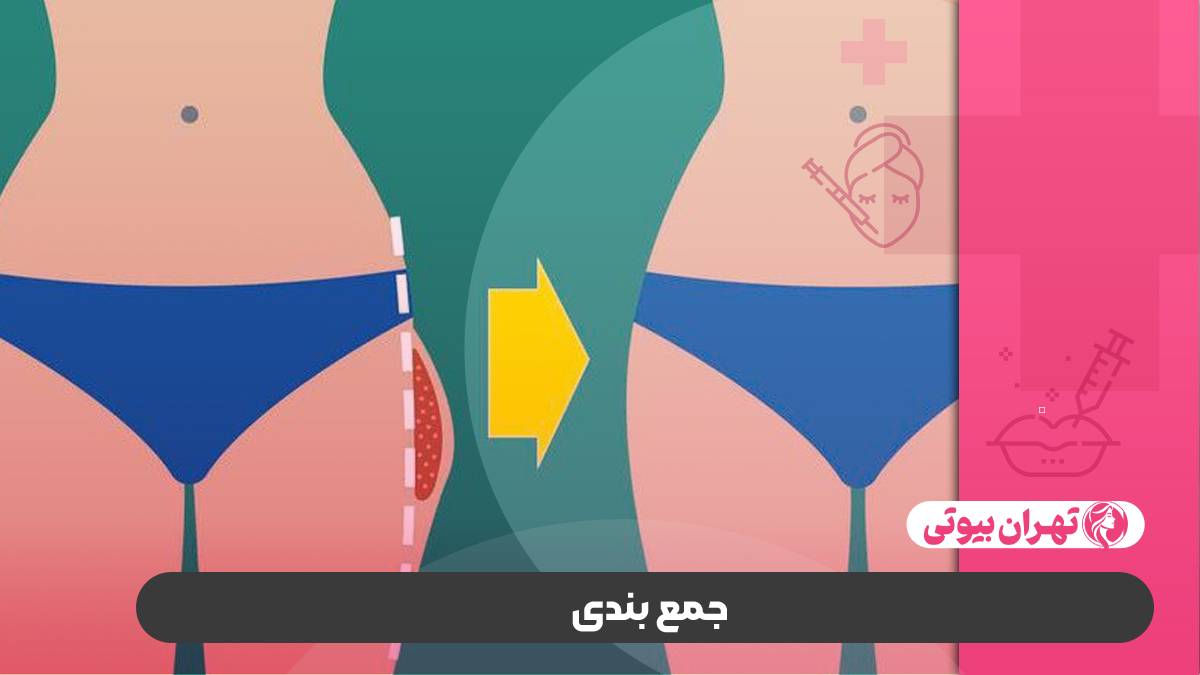 10 بهترین دکتر تزریق ژل به هیپ دیپ در کرج