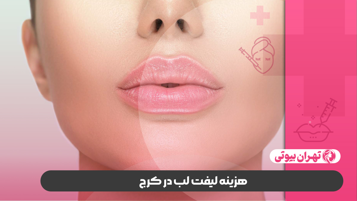 10 بهترین دکتر لیفت لب در کرج