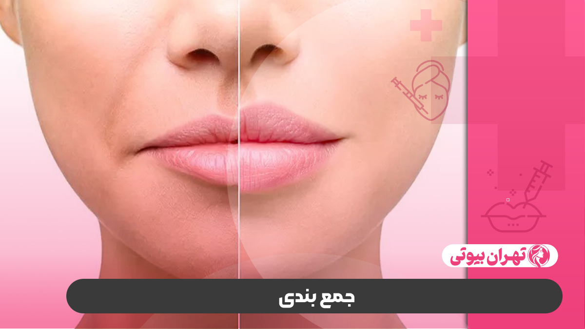10 بهترین دکتر لیفت لب در کرج