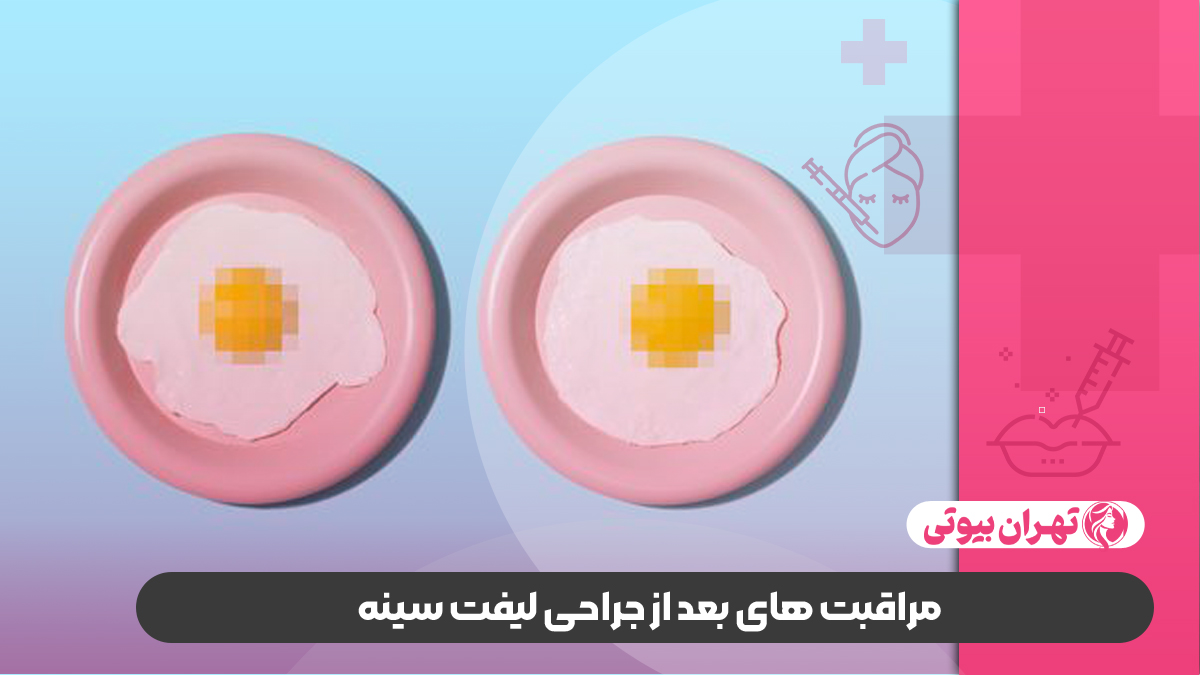 10 بهترین دکتر لیفت سینه در کرج