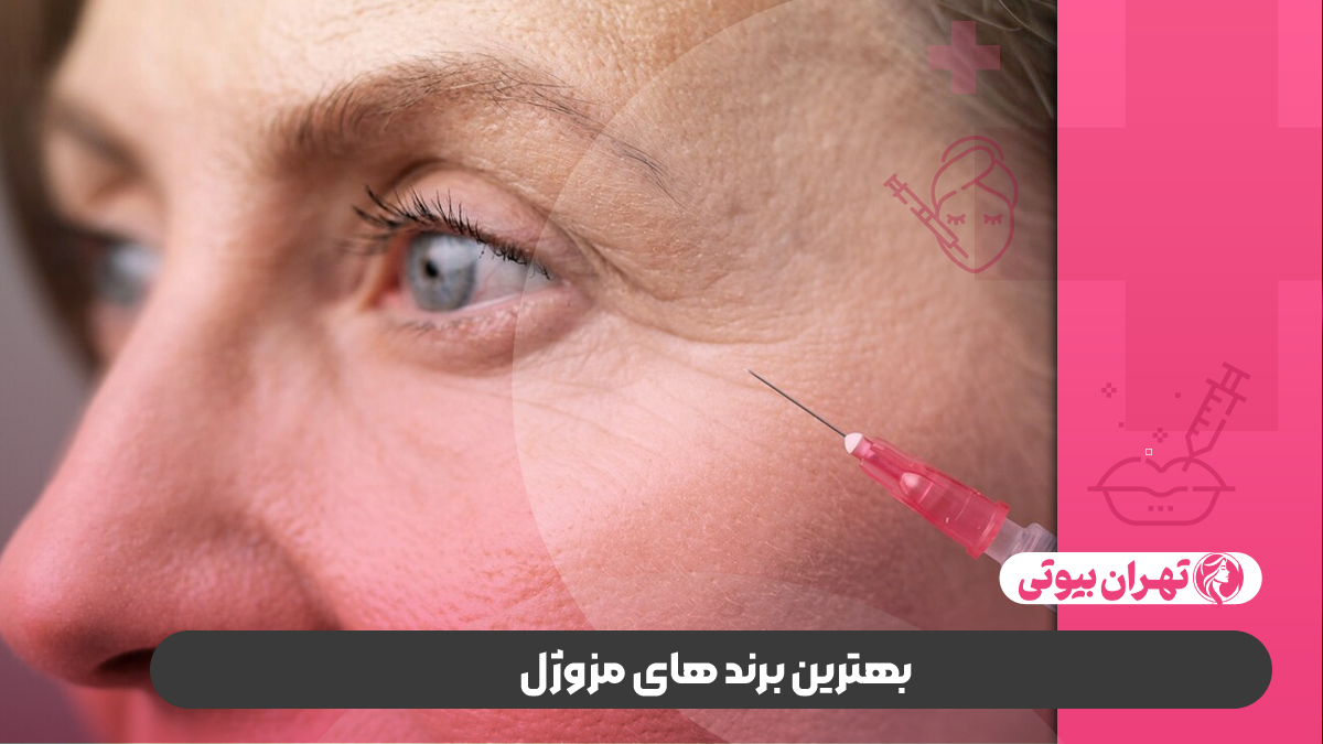 10 بهترین دکتر تزریق مزوژل در کرج