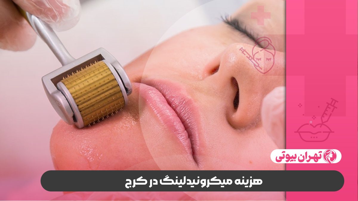 10 بهترین مرکز میکرونیدلینگ در کرج
