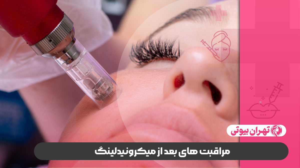 10 بهترین مرکز میکرونیدلینگ در کرج