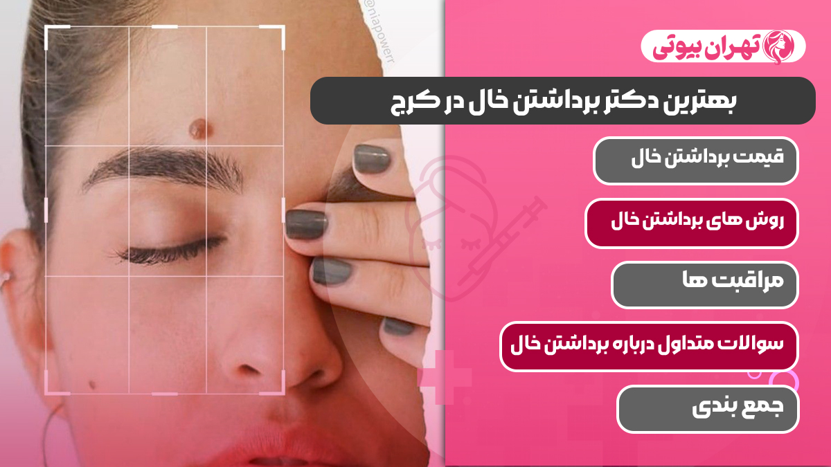 10 بهترین دکتر برداشتن خال در کرج