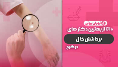 10 بهترین دکتر برداشتن خال در کرج