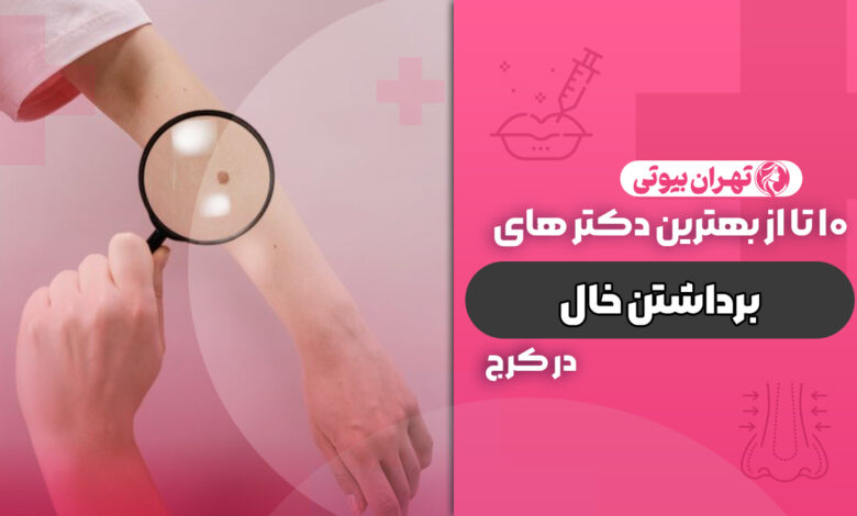 10 بهترین دکتر برداشتن خال در کرج
