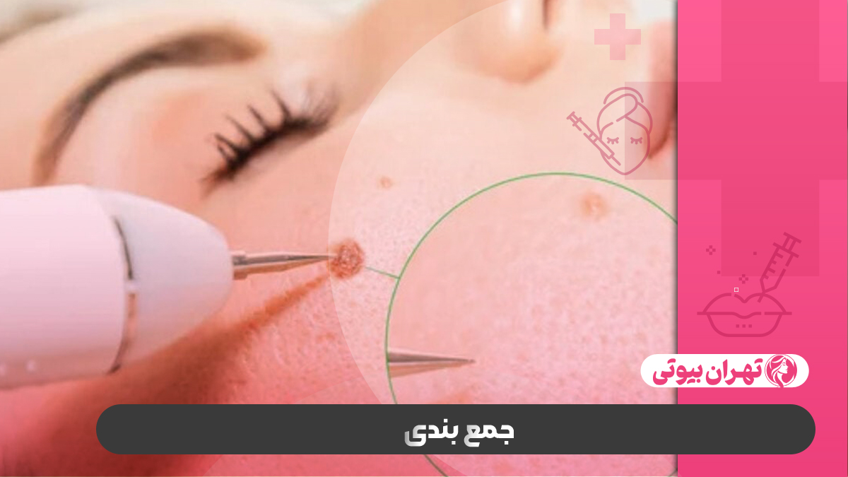 10 بهترین دکتر برداشتن خال در کرج