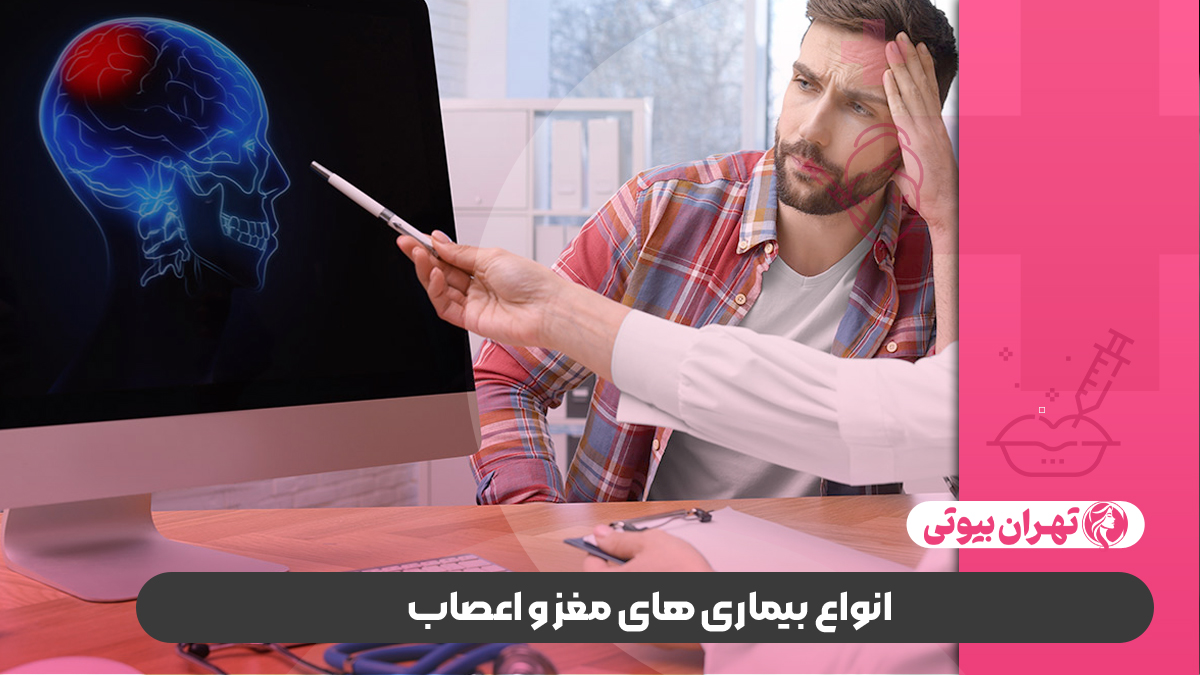 10 بهترین متخصص مغز و اعصاب در کرج