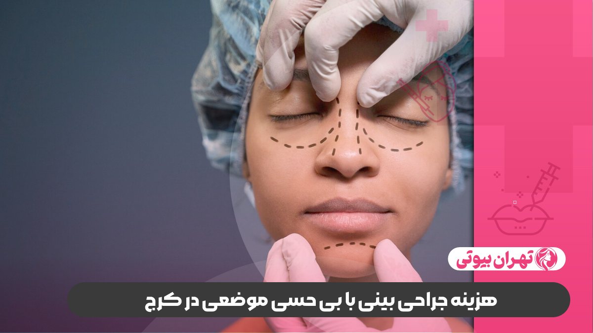 10 بهترین دکتر جراحی بینی با بی حسی موضعی در کرج