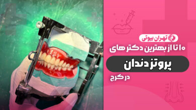 10 بهترین دکتر پروتز دندان در کرج