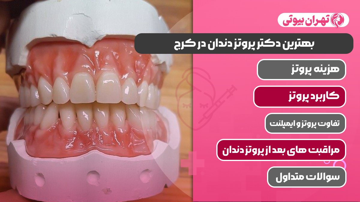 10 بهترین دکتر پروتز دندان در کرج