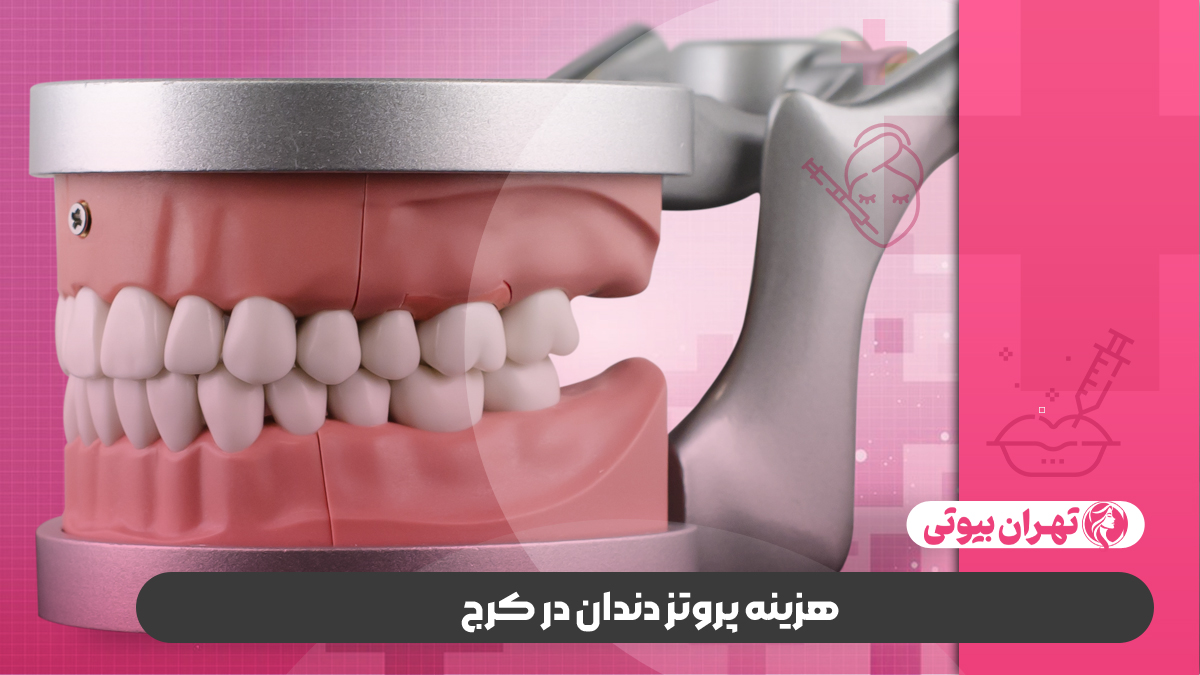 10 بهترین دکتر پروتز دندان در کرج