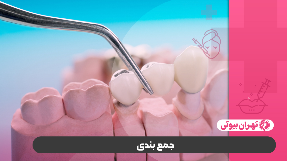 10 بهترین دکتر پروتز دندان در کرج