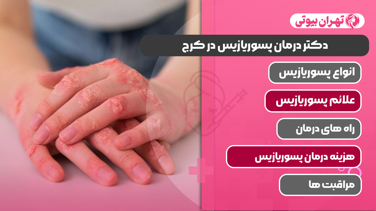 10 بهترین دکتر درمان پسوریازیس در کرج