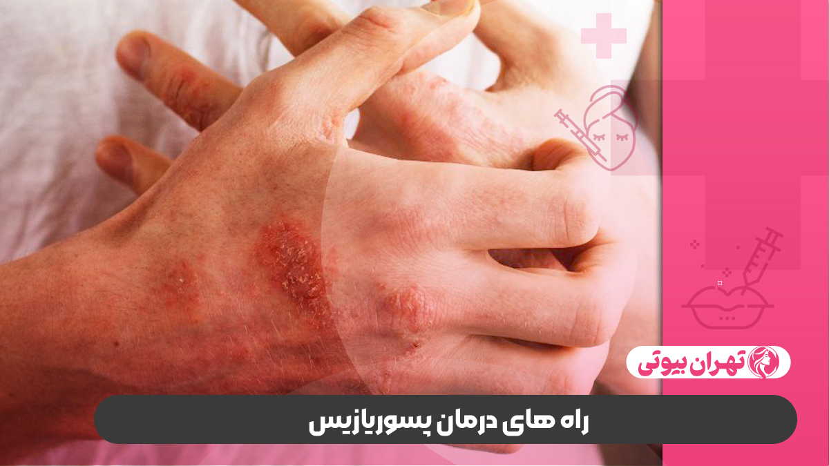 10 بهترین دکتر درمان پسوریازیس در کرج