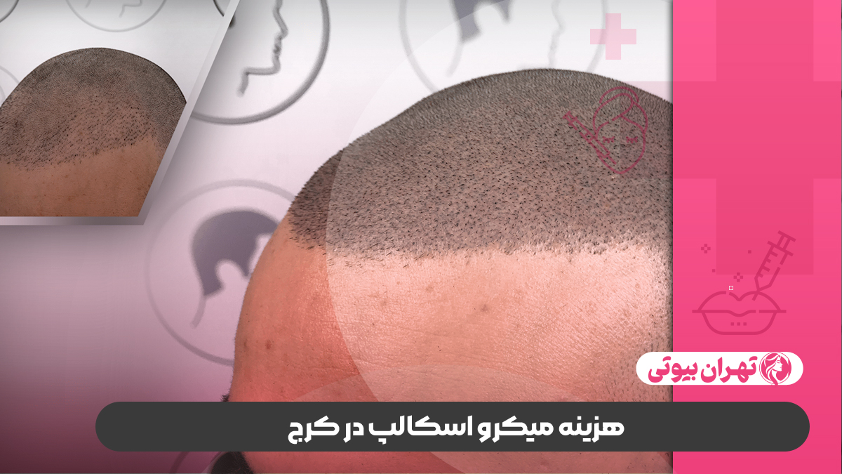 10 بهترین مرکز میکرواسکالپ در کرج