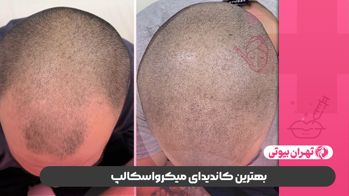 10 بهترین مرکز میکرواسکالپ در کرج