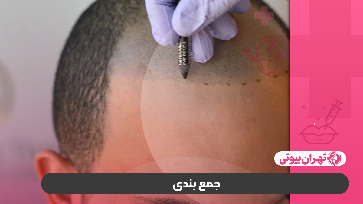 10 بهترین مرکز میکرواسکالپ در کرج