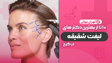 10 بهترین دکتر لیفت شقیقه در کرج