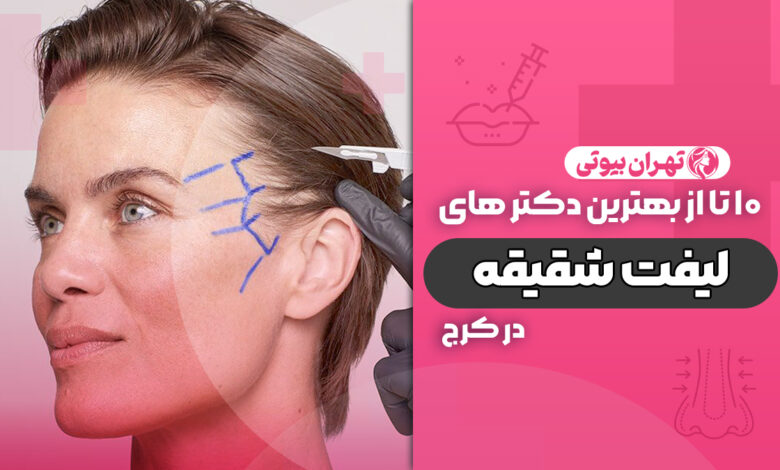 10 بهترین دکتر لیفت شقیقه در کرج