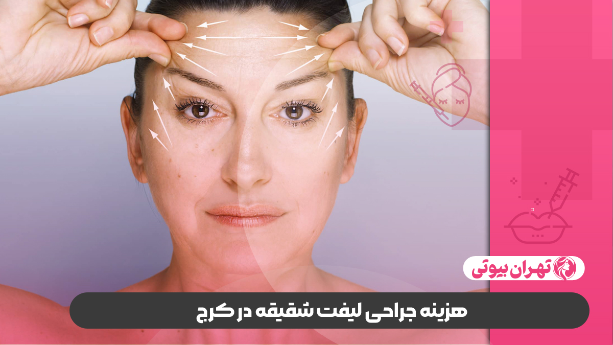 10 بهترین دکتر لیفت شقیقه در کرج