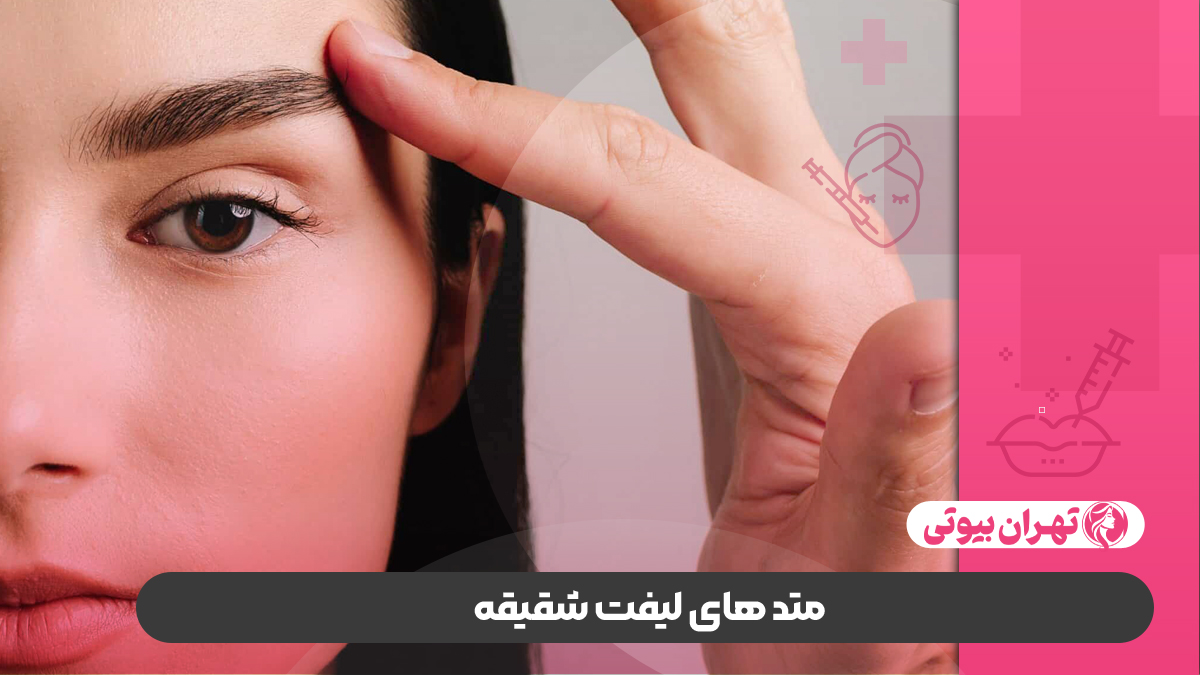 10 بهترین دکتر لیفت شقیقه در کرج