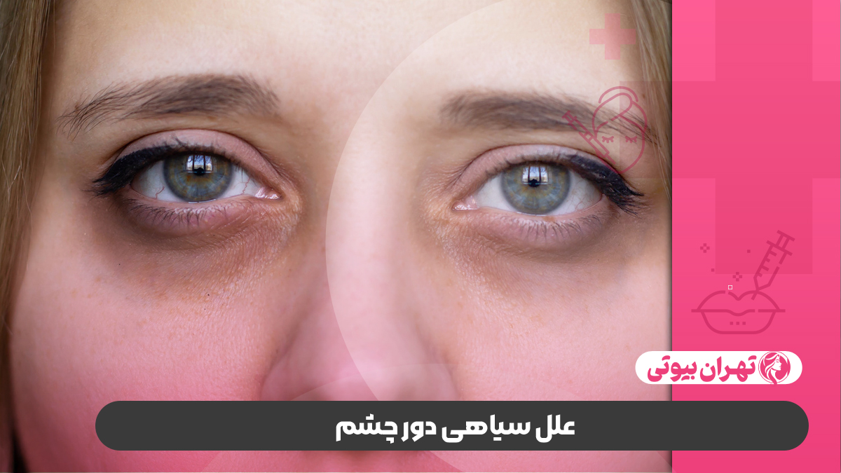 10 بهترین دکتر درمان سیاهی دور چشم در کرج