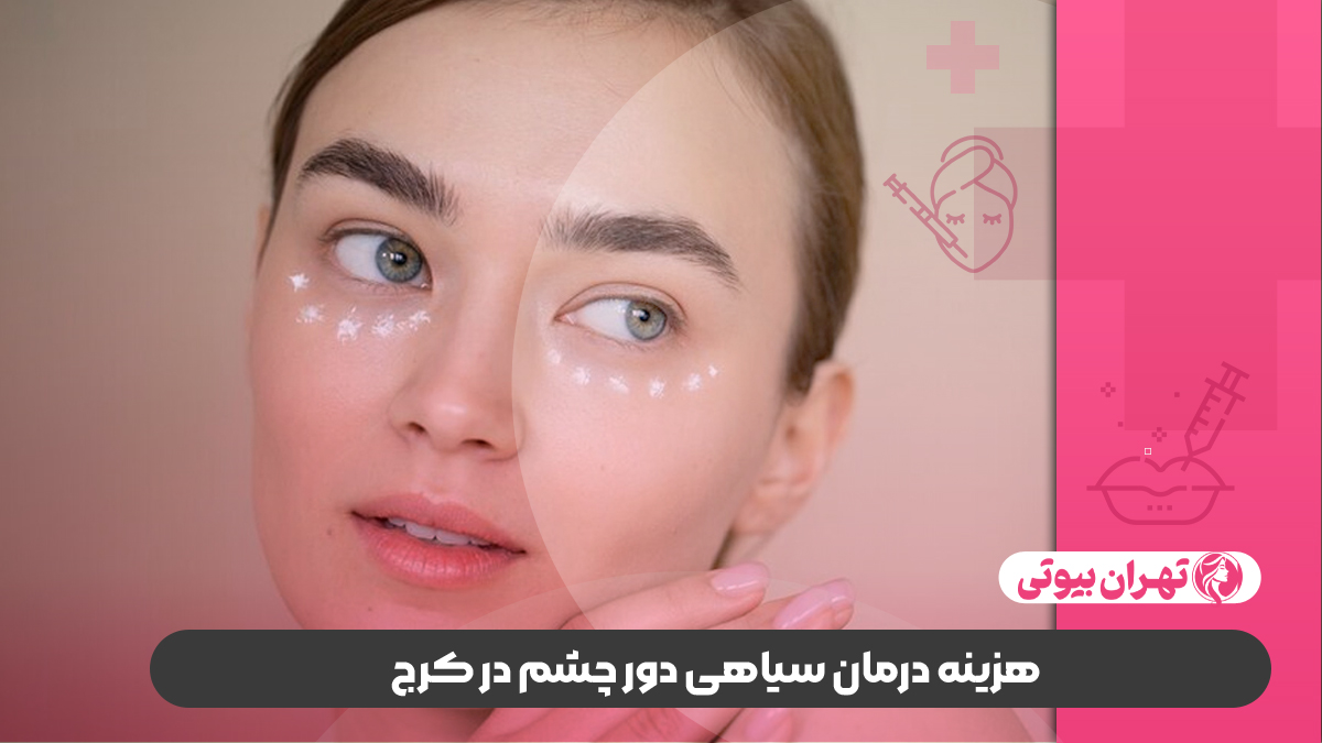 10 بهترین دکتر درمان سیاهی دور چشم در کرج