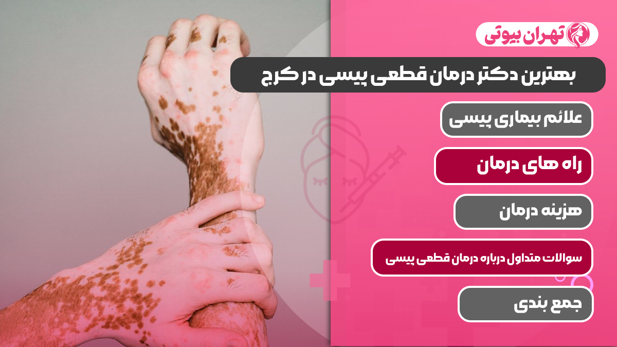 10 بهترین دکتر درمان قطعی پیسی در کرج (ویتیلیگو)