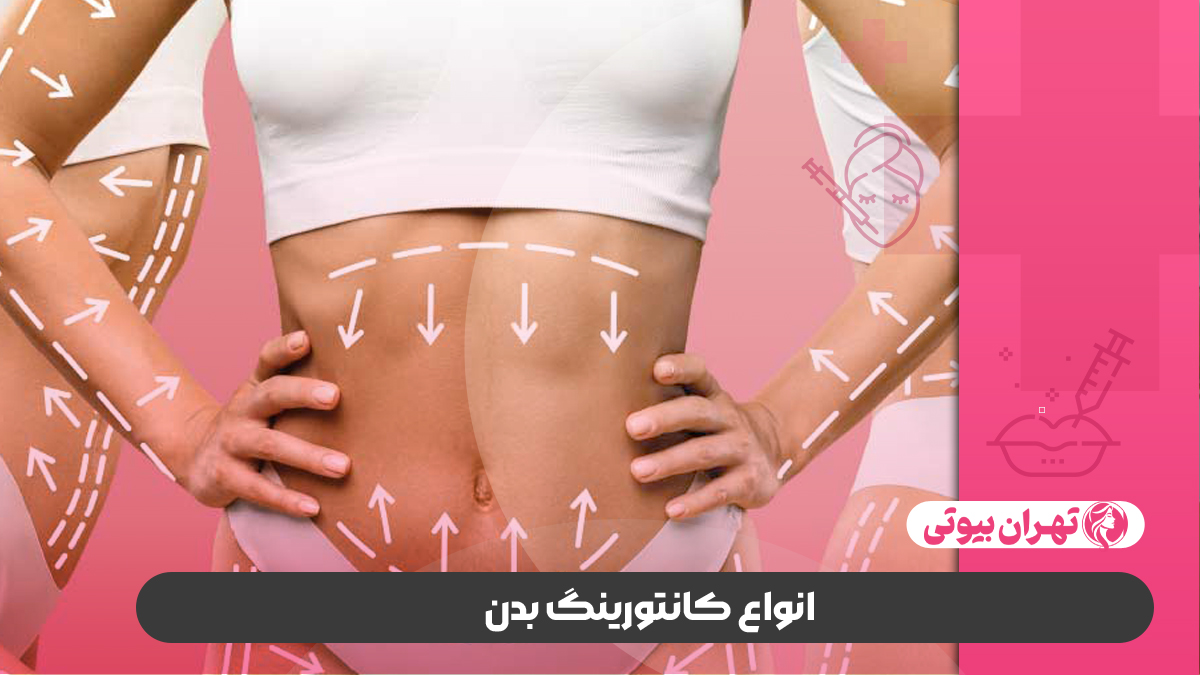 10 بهترین دکتر جراحی کانتورینگ بدن در تهران
