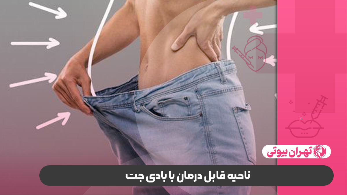 10 بهترین دکتر لاغری با بادی جت در کرج