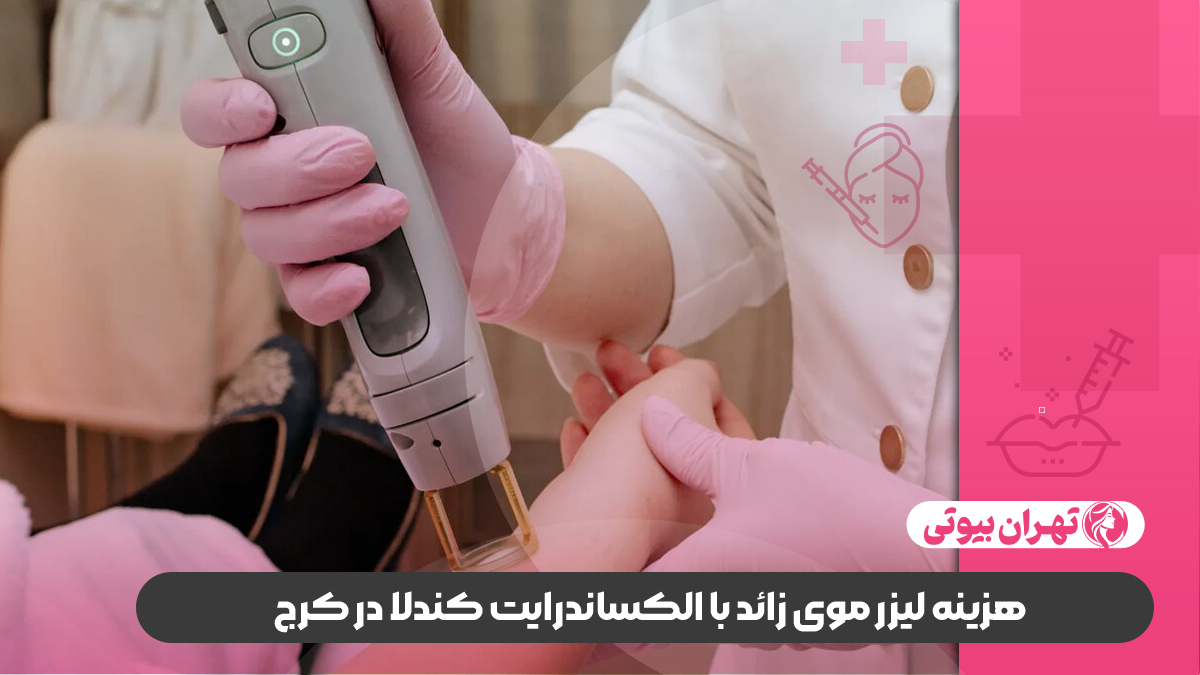 10 بهترین مرکز لیزر الکساندرایت کندلا در کرج