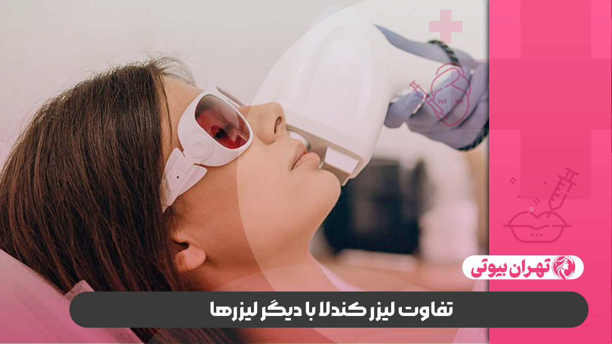 10 بهترین مراکز لیزر الکساندرایت کندلا در تهران