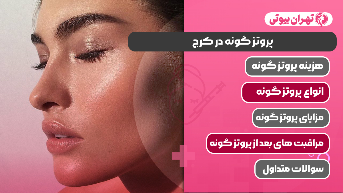 10 بهترین دکتر پروتز گونه در کرج