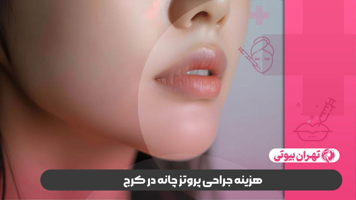 10 بهترین جراح پروتز چانه در کرج