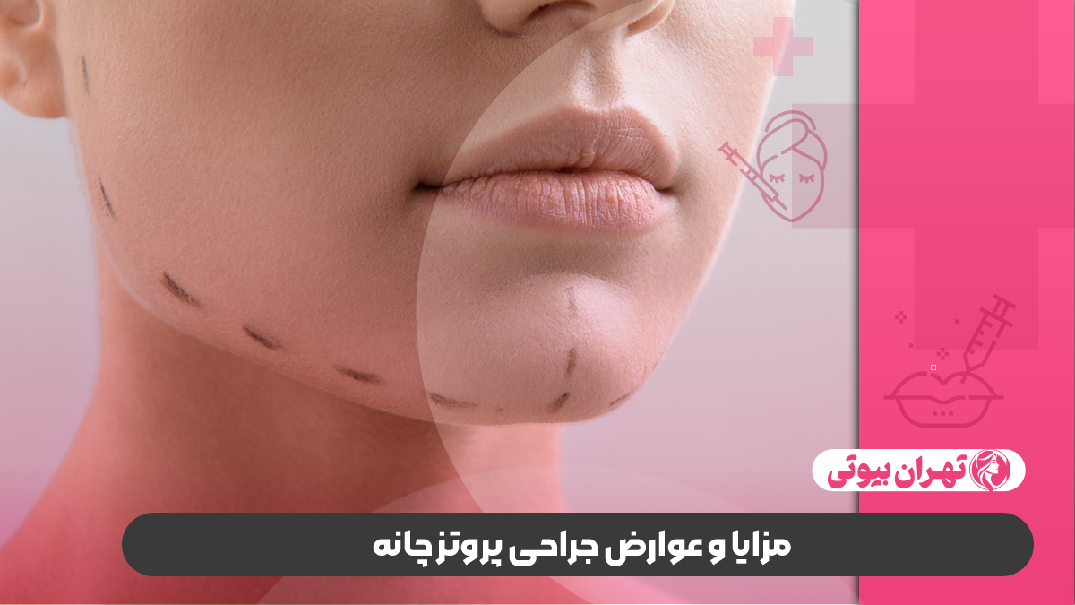 10 بهترین جراح پروتز چانه در کرج