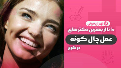 10 بهترین دکتر چال گونه در کرج