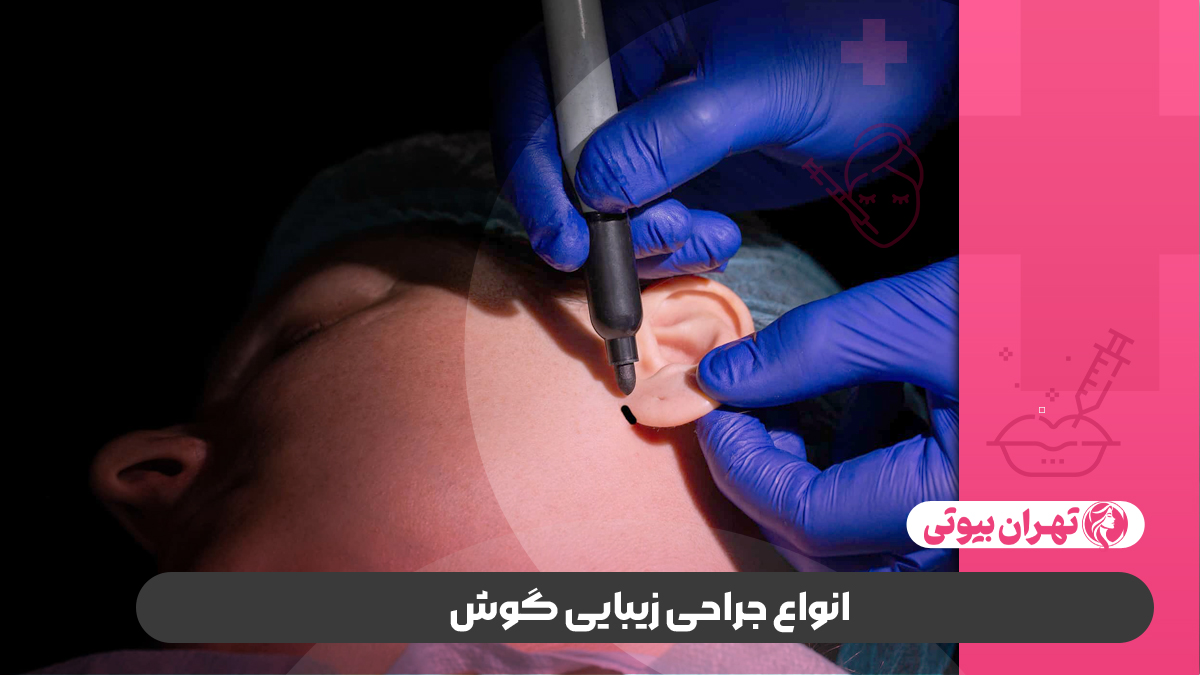 10 بهترین دکتر جراحی زیبایی گوش (اتوپلاستی) در کرج