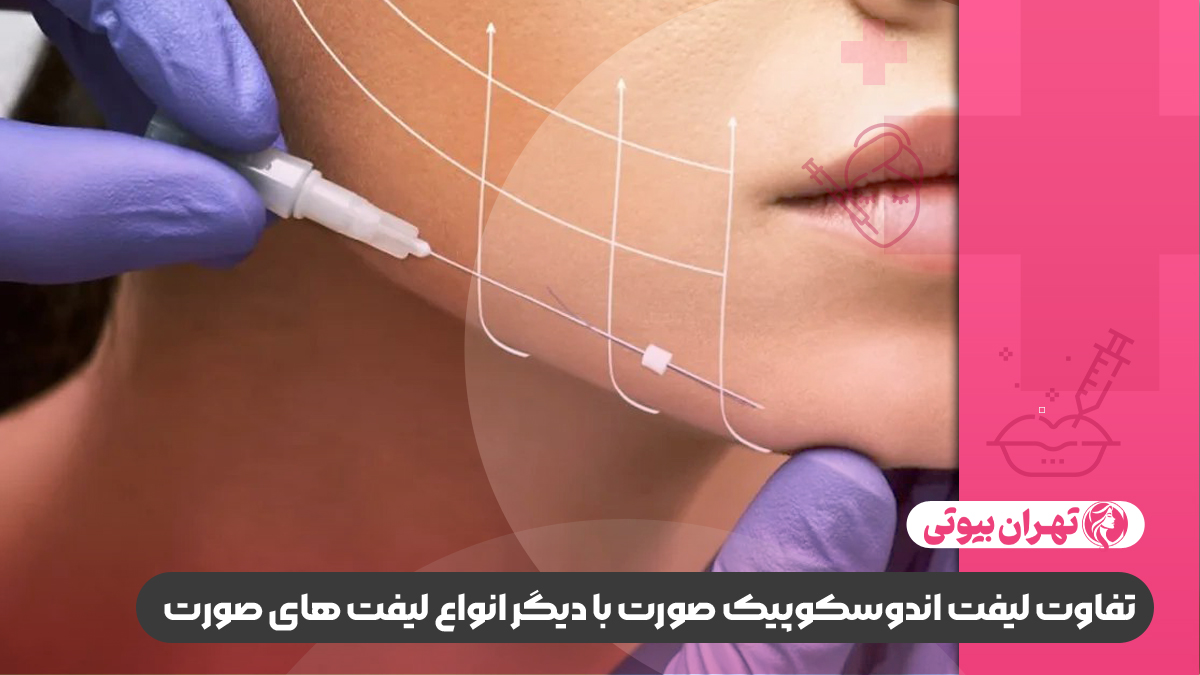 10 بهترین دکتر لیفت اندوسکوپیک صورت در کرج
