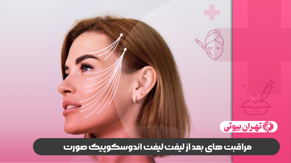 10 بهترین دکتر لیفت اندوسکوپیک صورت در کرج