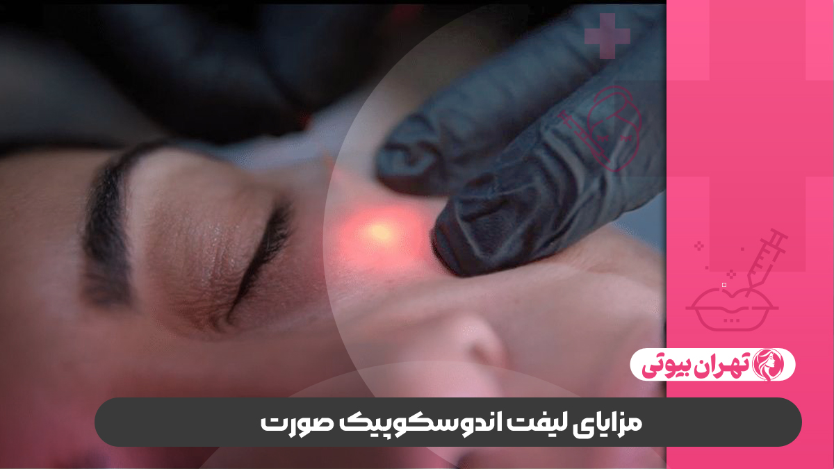 10 بهترین دکتر لیفت اندوسکوپیک صورت در تهران