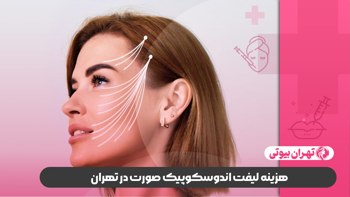 10 بهترین دکتر لیفت اندوسکوپیک صورت در تهران
