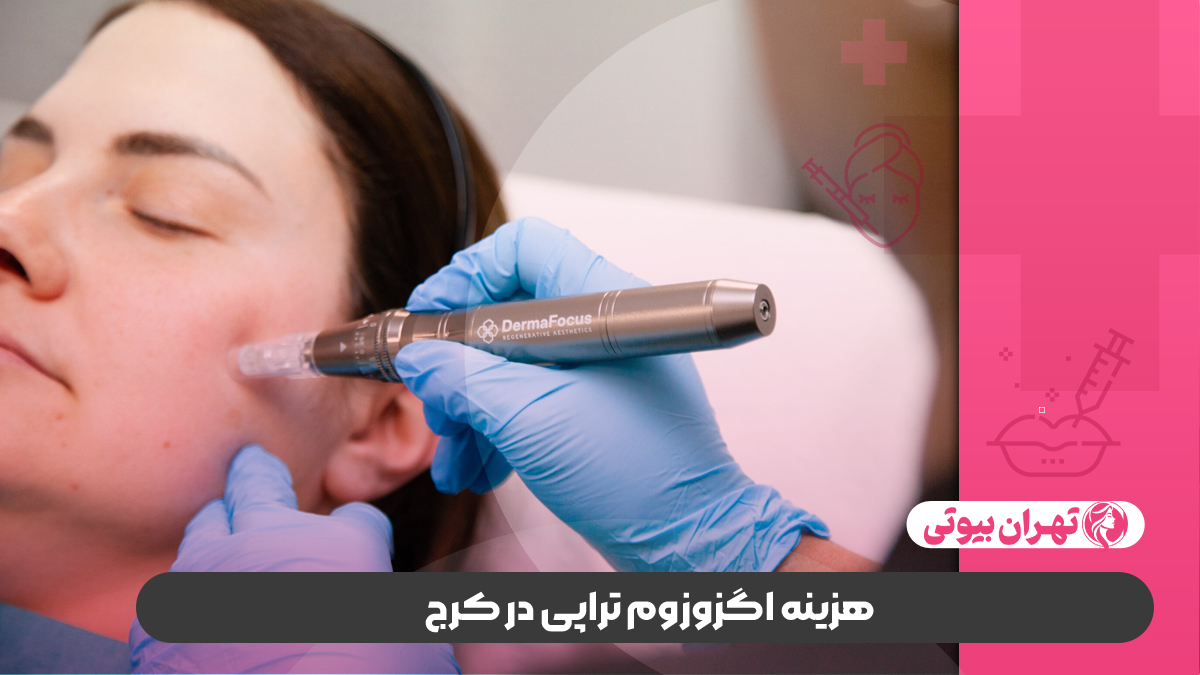 10 بهترین دکتر اگزوزوم تراپی در کرج