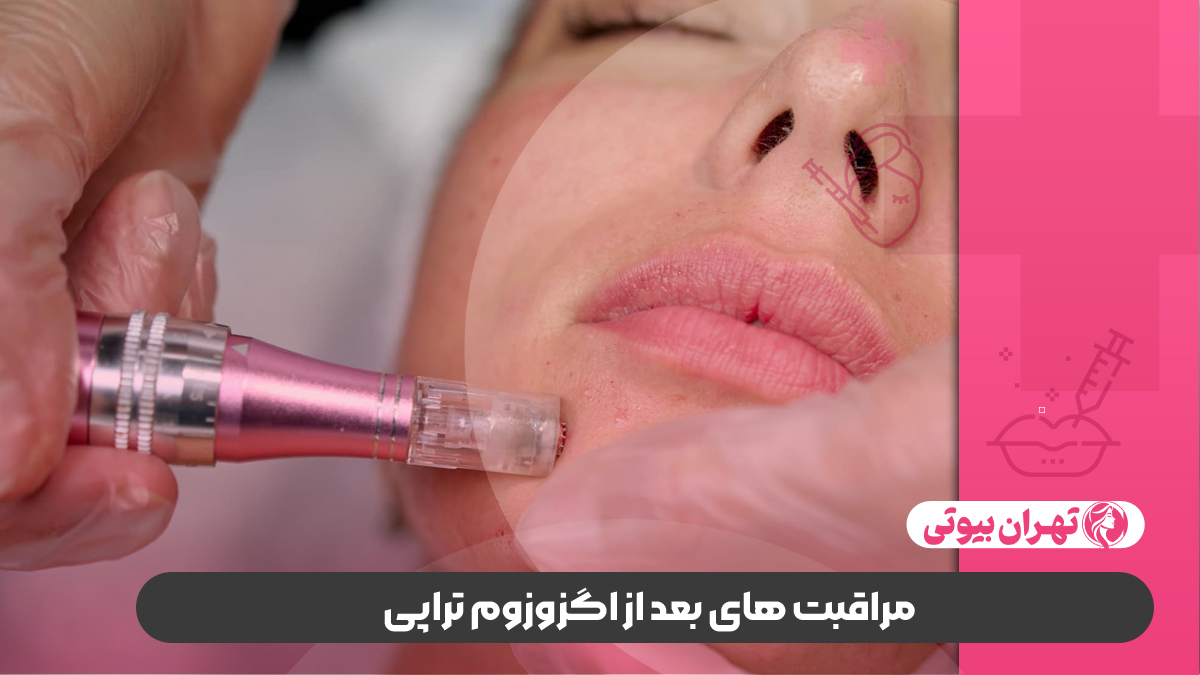 10 بهترین دکتر اگزوزوم تراپی در کرج