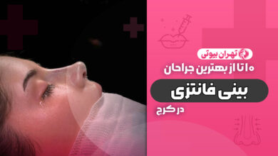 10 بهترین دکتر جراح بینی فانتزی در کرج