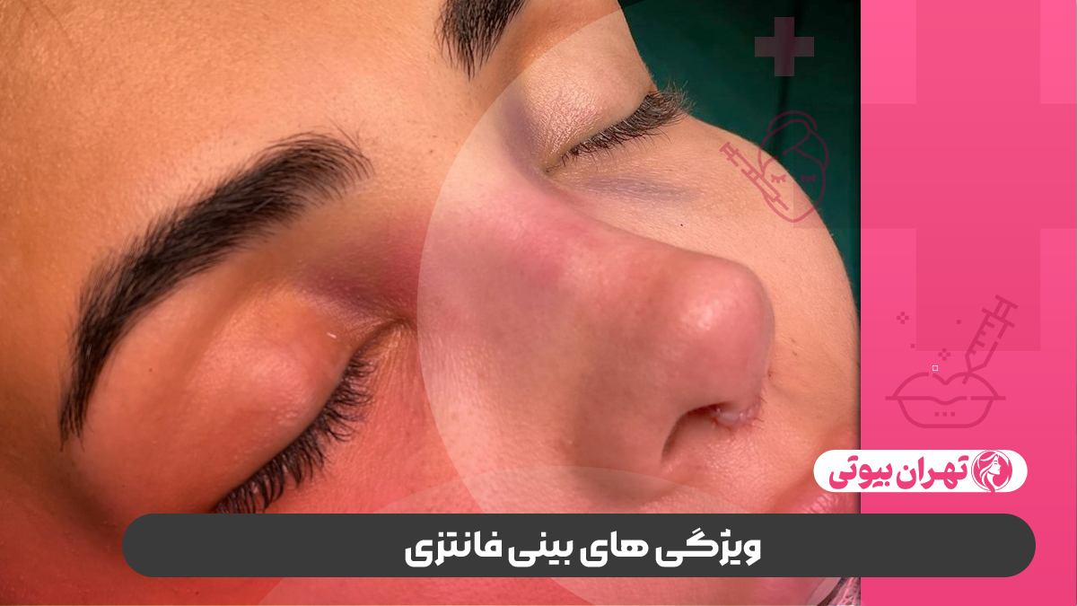 10 بهترین دکتر جراح بینی فانتزی در کرج