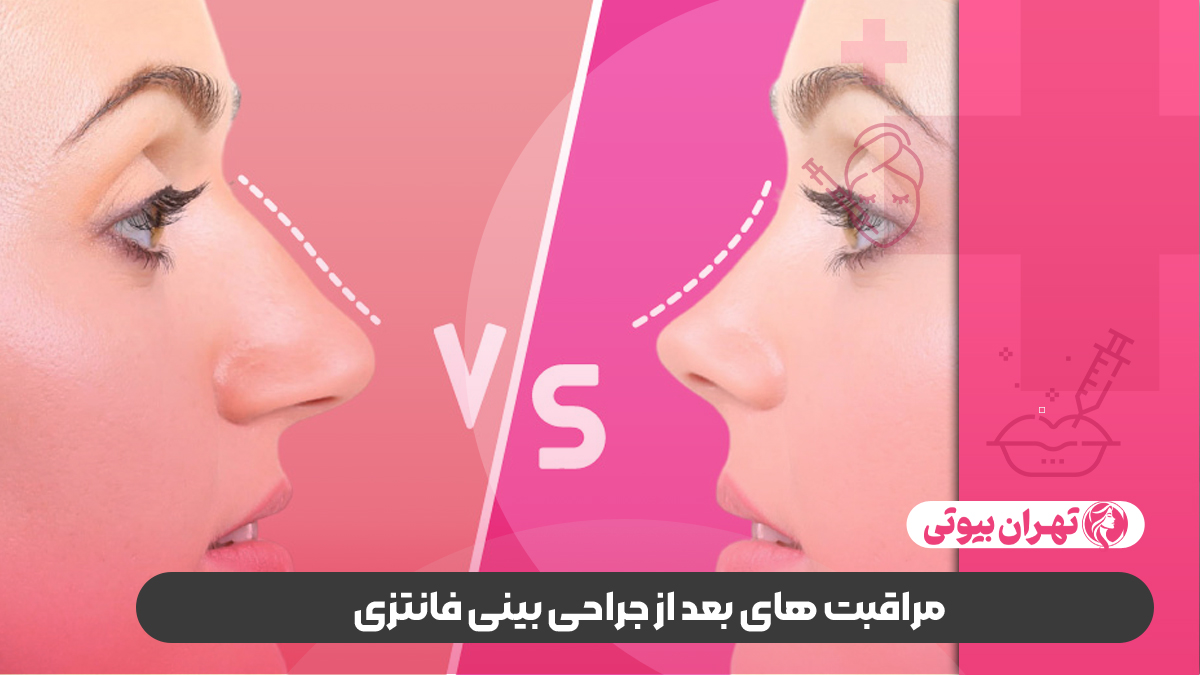 10 بهترین دکتر جراح بینی فانتزی در کرج
