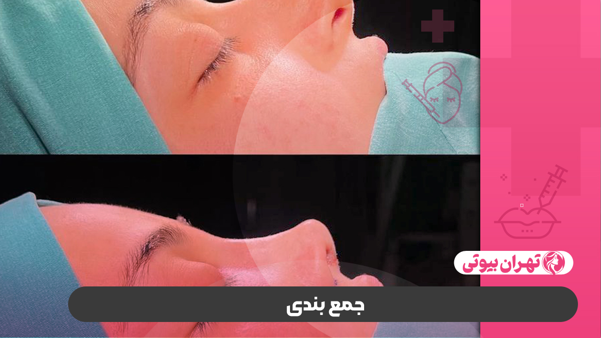 10 بهترین دکتر جراح بینی فانتزی در کرج