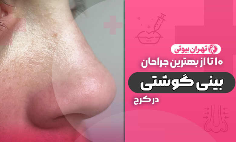10 بهترین دکتر جراح بینی گوشتی در کرج